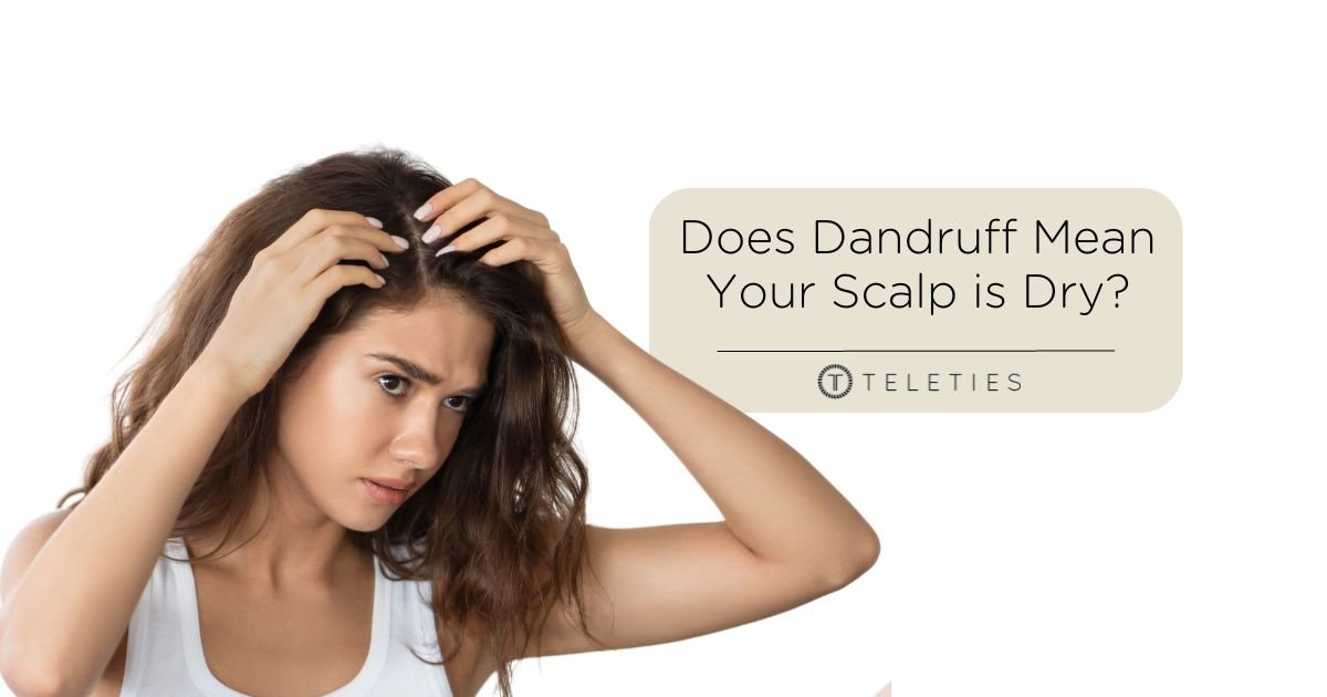 Does dandruff mean my scalp is dry? - TELETIES